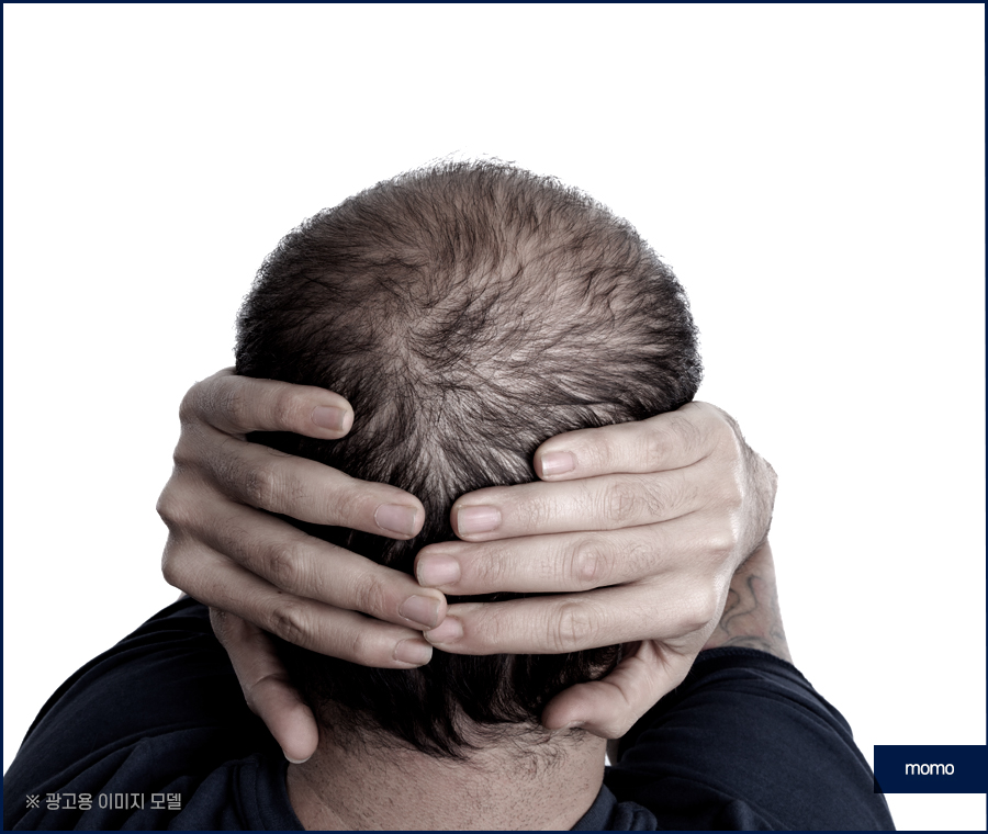 남자 헤어라인 교정 불규칙한 라인 보완을 위해 관련 이미지 11