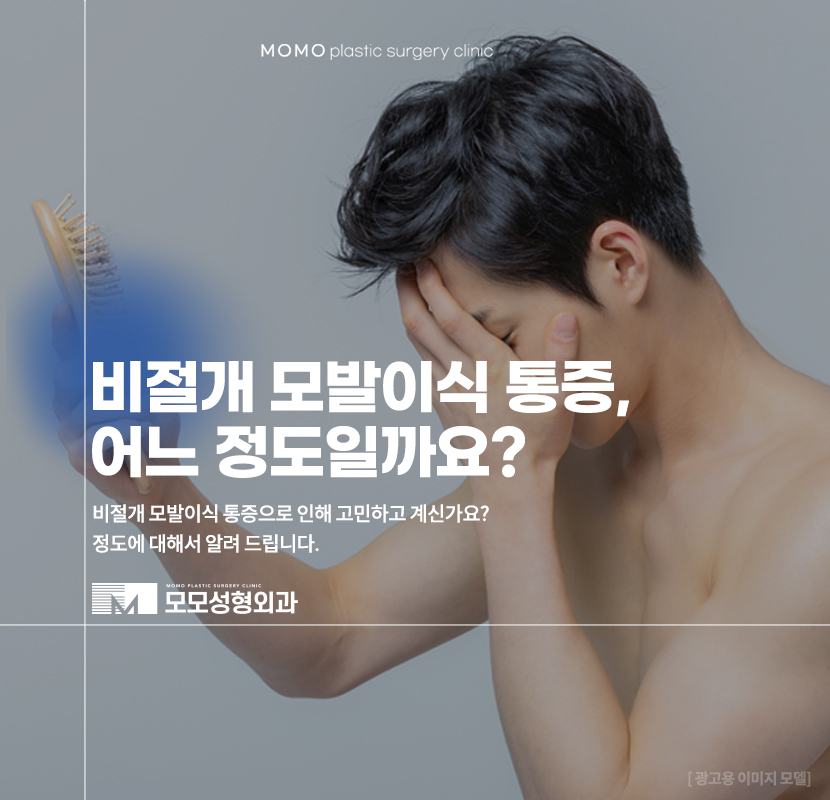 비절개모발이식통증 비교할 때 꼭 알아야 하는 점 관련 이미지 1
