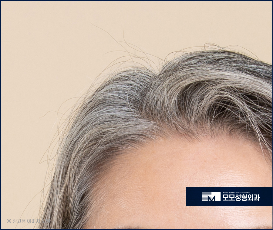 새치염색주기 무리를 주지 않는 선은 관련 이미지 8