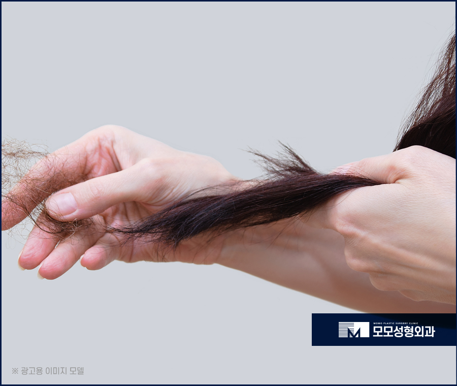 여자모발이식후기 다양하게 비교해 보아야만 관련 이미지 3