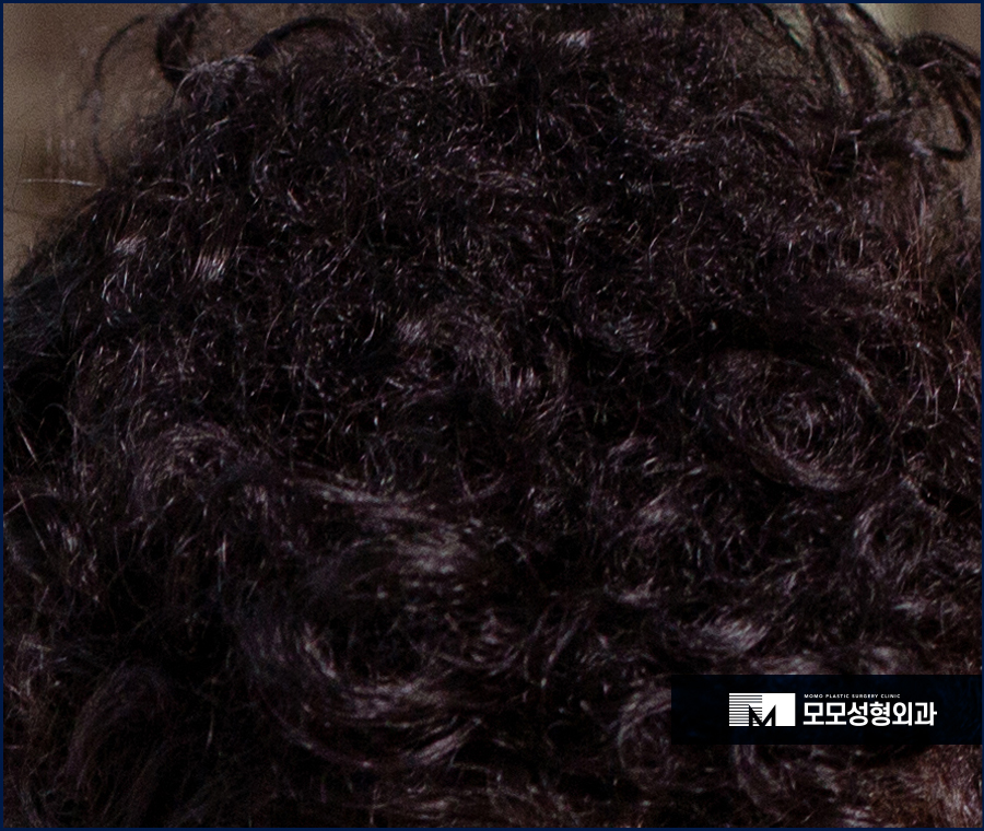 곱슬머리원인 개선 방법에 대해 관련 이미지 3