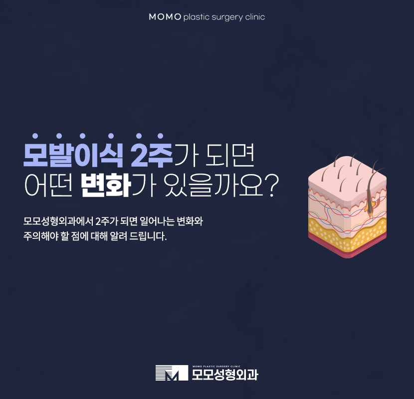 모발이식2주가 되면 어떤 변화가 찾아올까요 관련 이미지 1