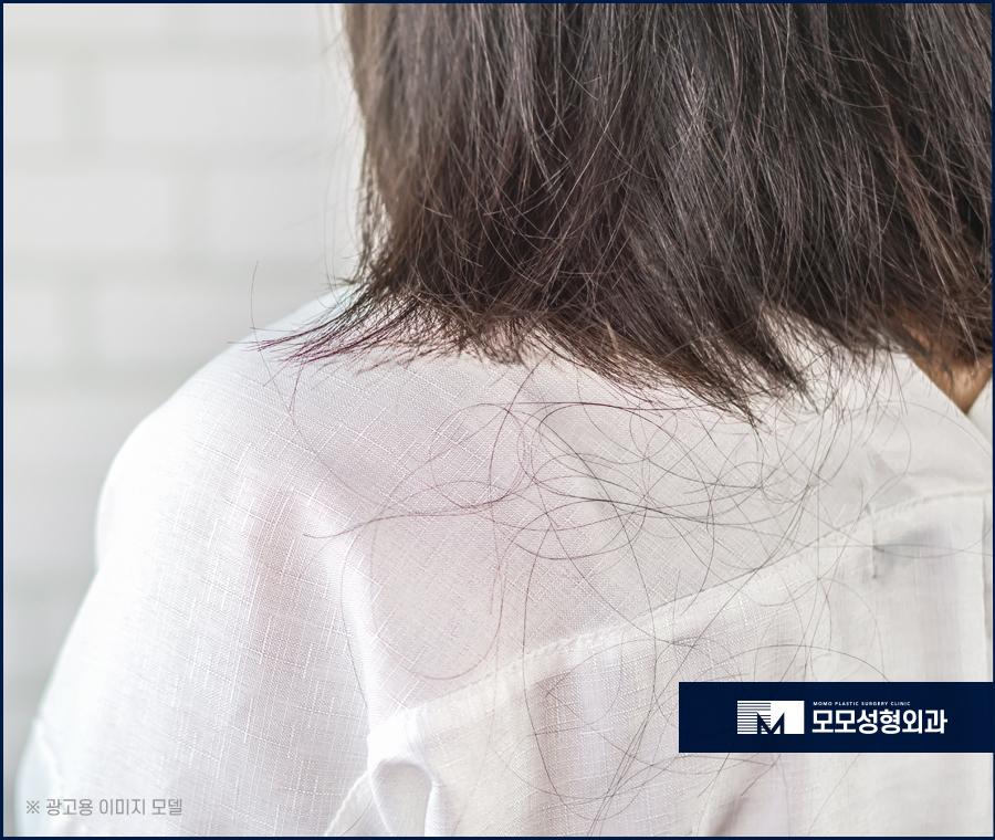 여자M자이마탈모 개인맞춤 진행의 중요성에 대하여 관련 이미지 4
