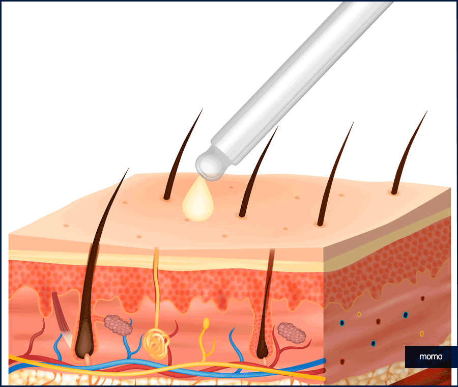 탈모약 복용시간의 중요성 및 주의사항 정리 관련 이미지 7