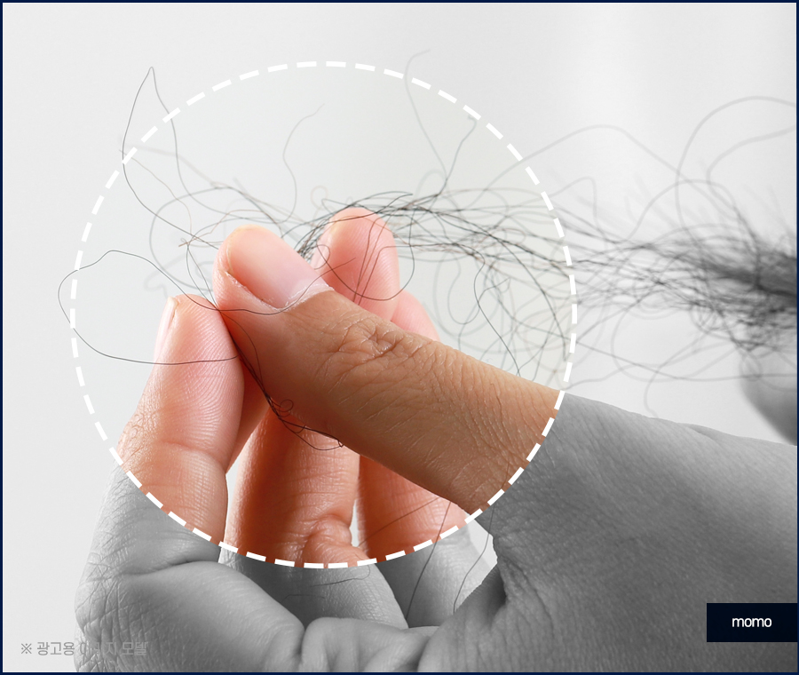 무삭발 모발이식 빠르게 회복하려면 관련 이미지 2