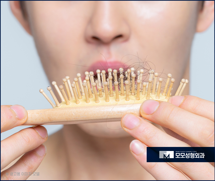 모발이식5000모 얼굴형까지 적절히 유념해서 관련 이미지 4