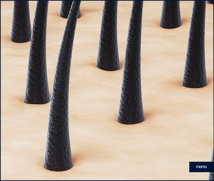 앞머리 모발이식 비용 개인에 따라 달라지는 이유 관련 이미지 8