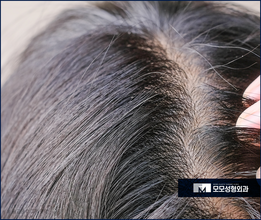 새치염색주기 무리를 주지 않는 선은 관련 이미지 5