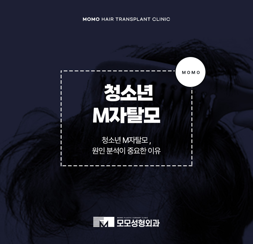 청소년 m자 탈모 요인 분석이 중요한 이유 관련 이미지 1