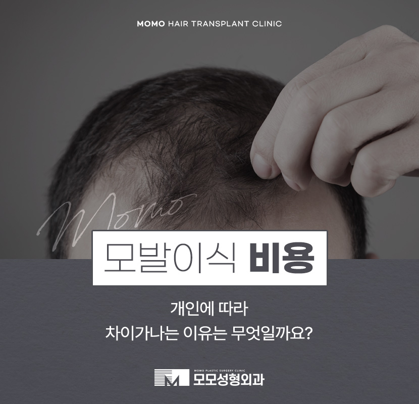 모발이식 금액 개인마다 차이가 나는 이유 관련 이미지 1