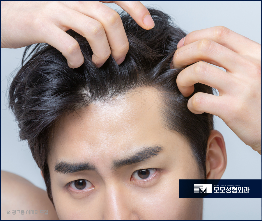 남자헤어라인교정 정교하게 채우고 생착률을 높이는 관련 이미지 2