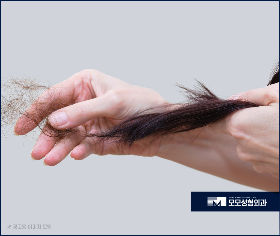 여자가르마탈모 수복을 위한 시술은 관련 이미지 4