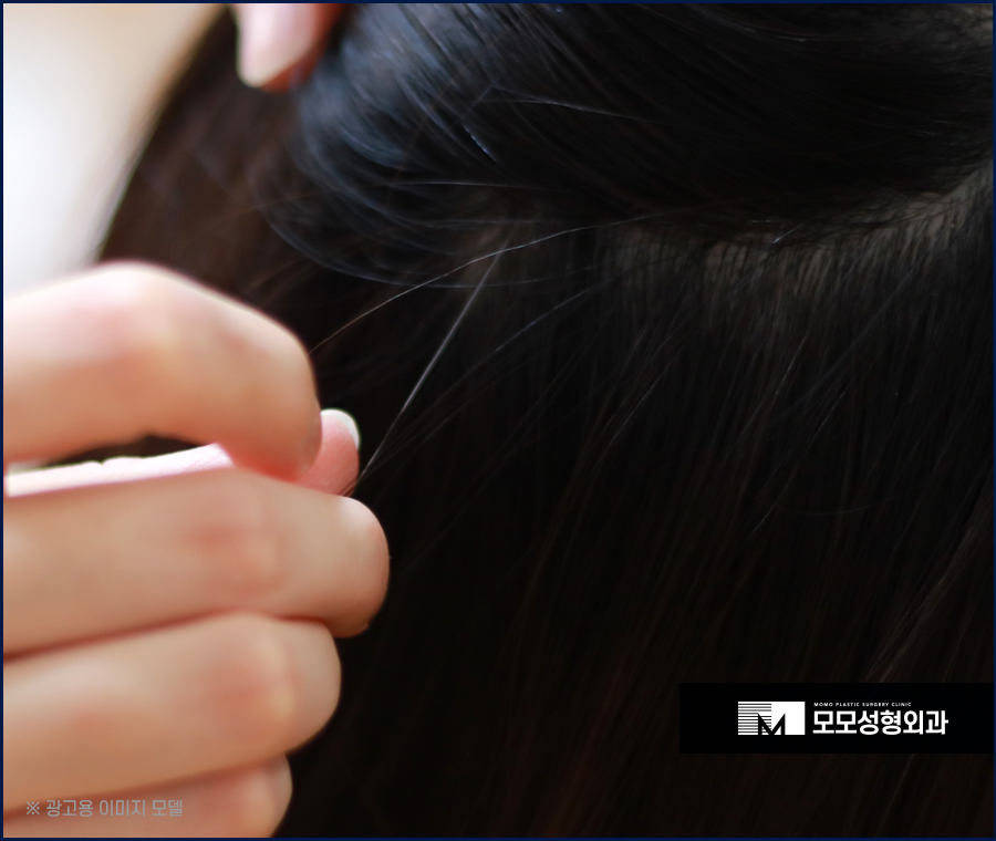 흰머리 가려움 어떻게 완화시킬 수 있을까요 관련 이미지 4