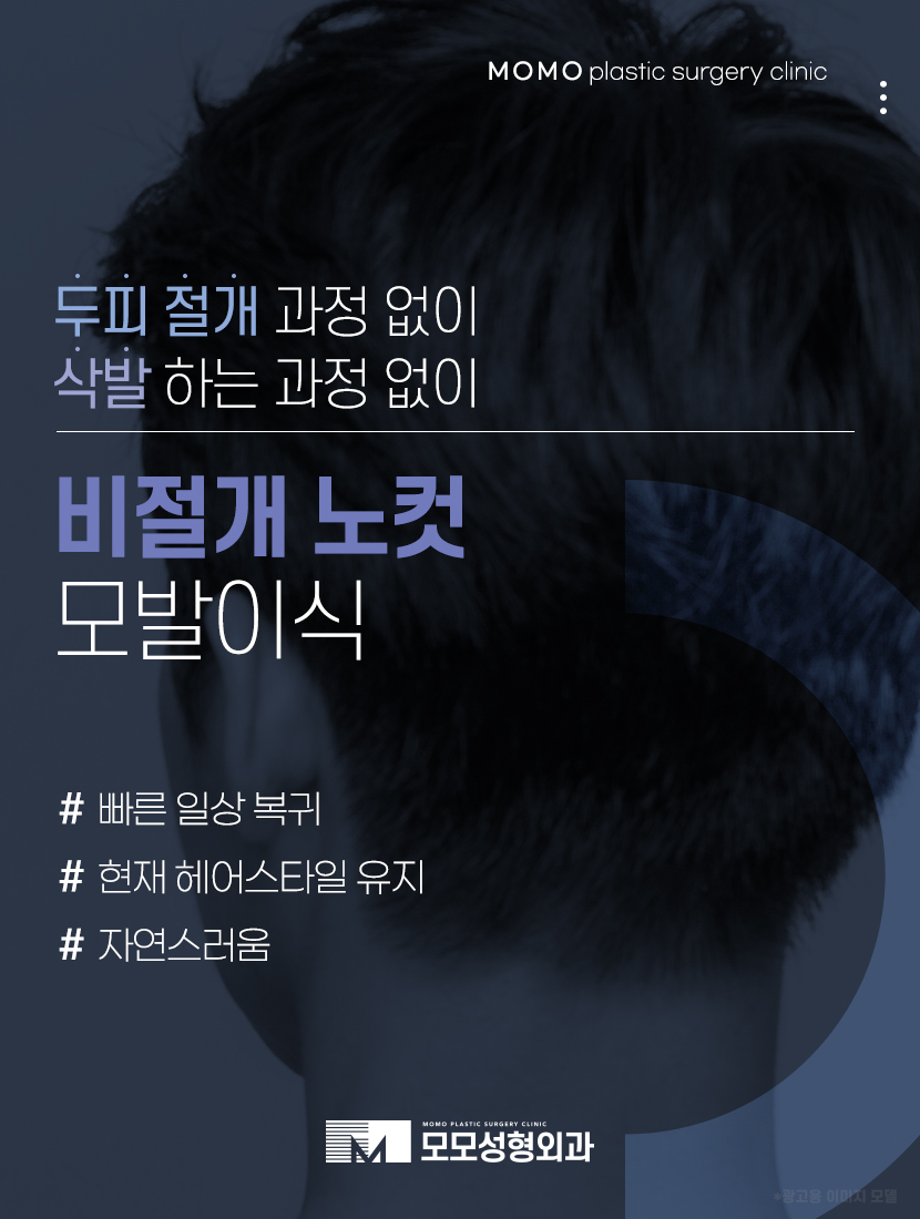 헤어라인교정후기 특성을 고려해서 관련 이미지 10