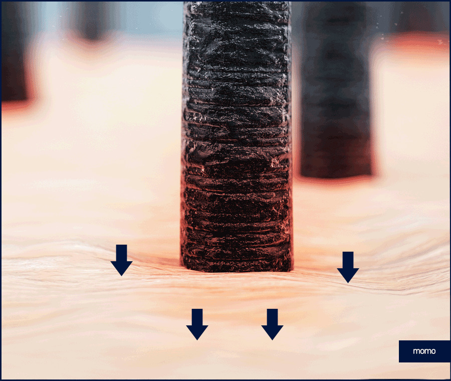 탈모 클리닉 비용의 기준이 되는 조건은? 관련 이미지 9
