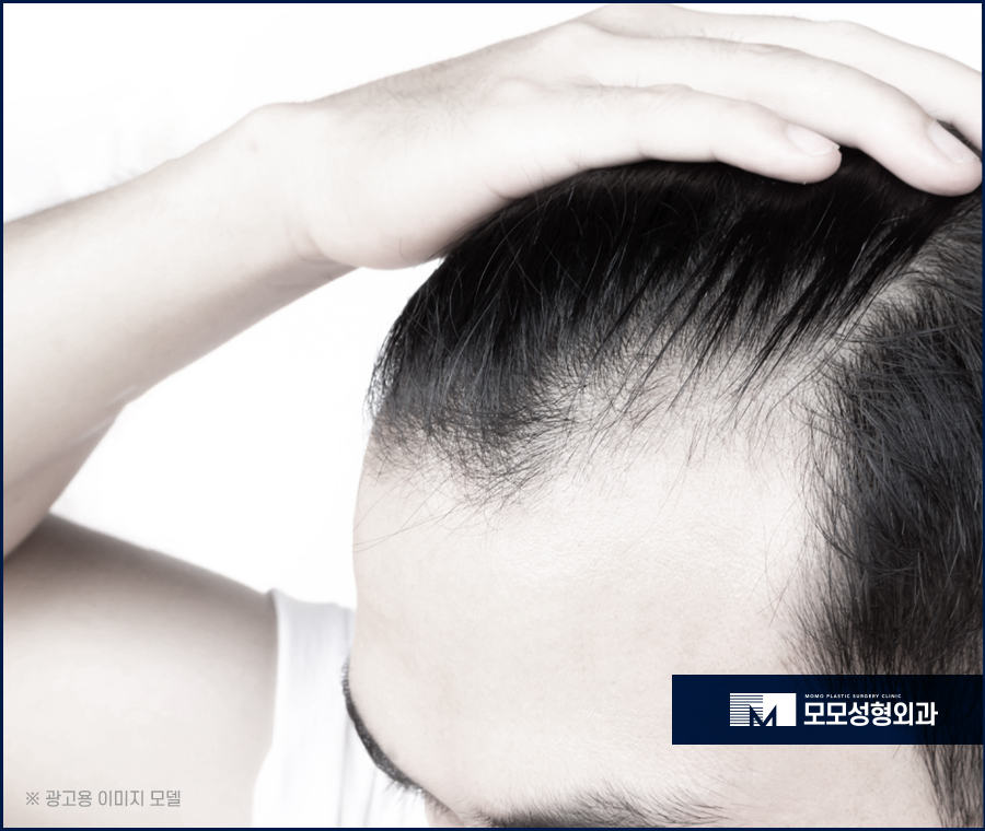 무삭발모발이식 비절개로 걱정을 줄이며 관련 이미지 2