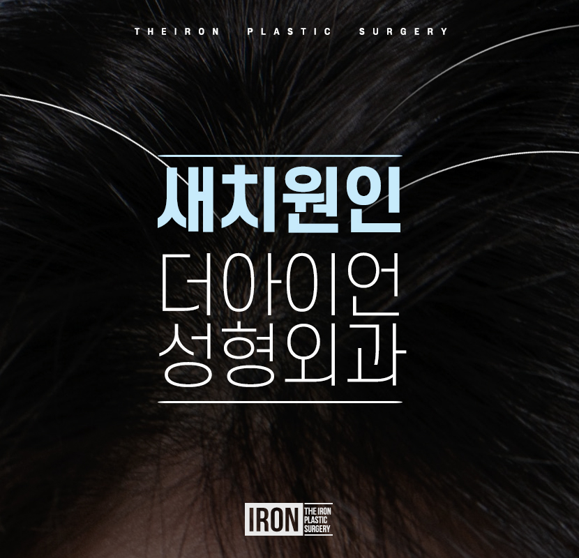 새치원인 파악할 필요가 있다면 관련 이미지 1