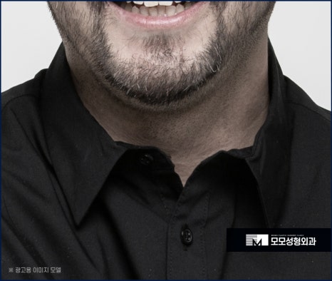 체모 이식 부위별 특성 고려해서 자연스런 결과로 관련 이미지 8