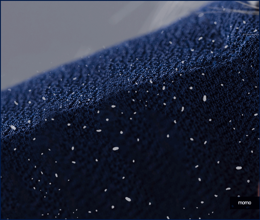 머리 감아도 비듬이 나타나는 이유 및 제거 팁 관련 이미지 6