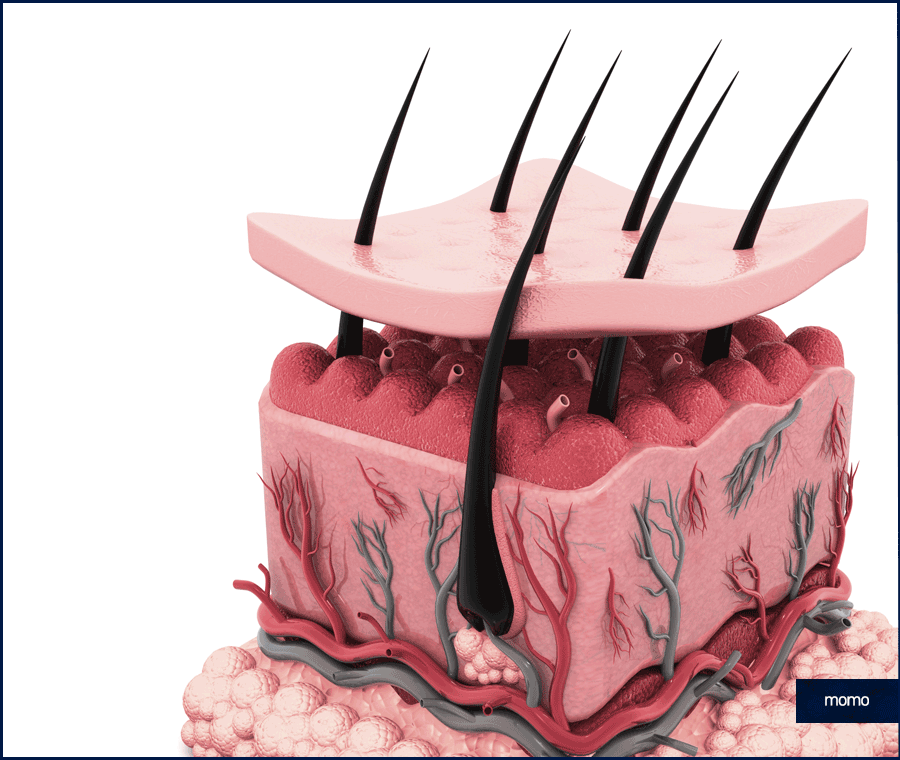 여자 모발이식 헤어라인 교정이 필요하다면 관련 이미지 9
