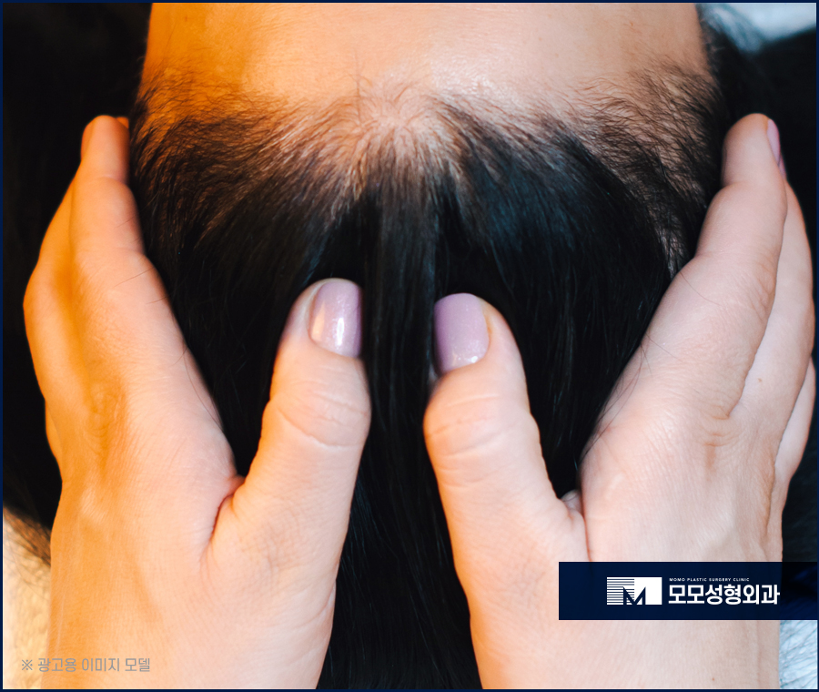 머리카락얇아짐 원인과 방치해선 안되는 이유 관련 이미지 10