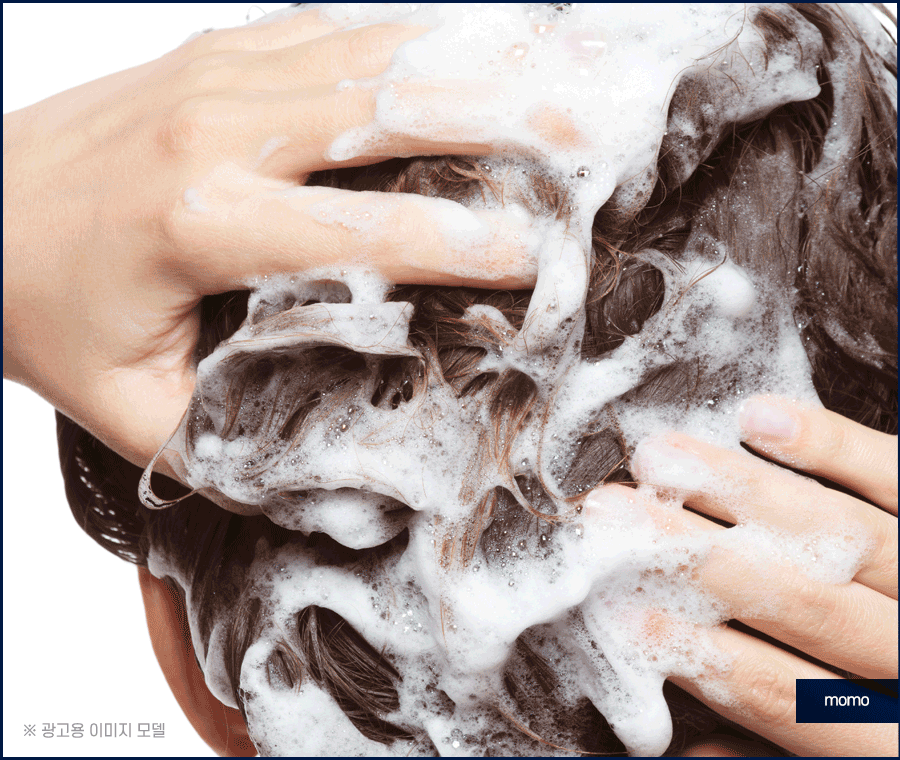 여자 가르마 탈모 모발이식으로 효과보려면? 관련 이미지 5