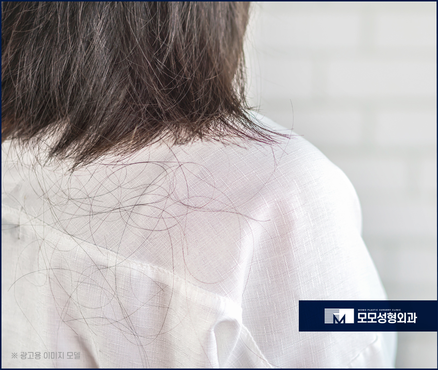 미녹시딜여자 효과와 치료 방안에 대해 관련 이미지 3