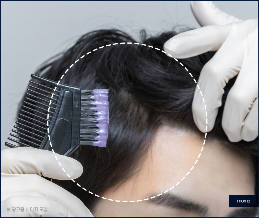 염색후 두피 가려움 원인과 완화 방법 관련 이미지 4