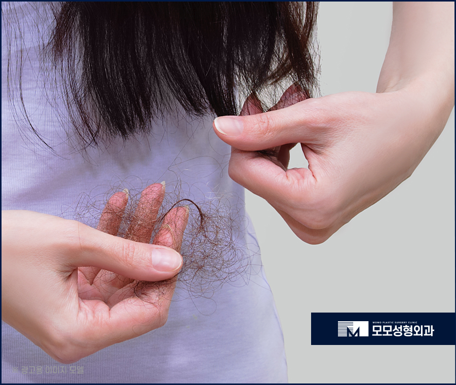 여자헤어라인모발이식 정돈된 미모를 완성하는 방법 관련 이미지 3