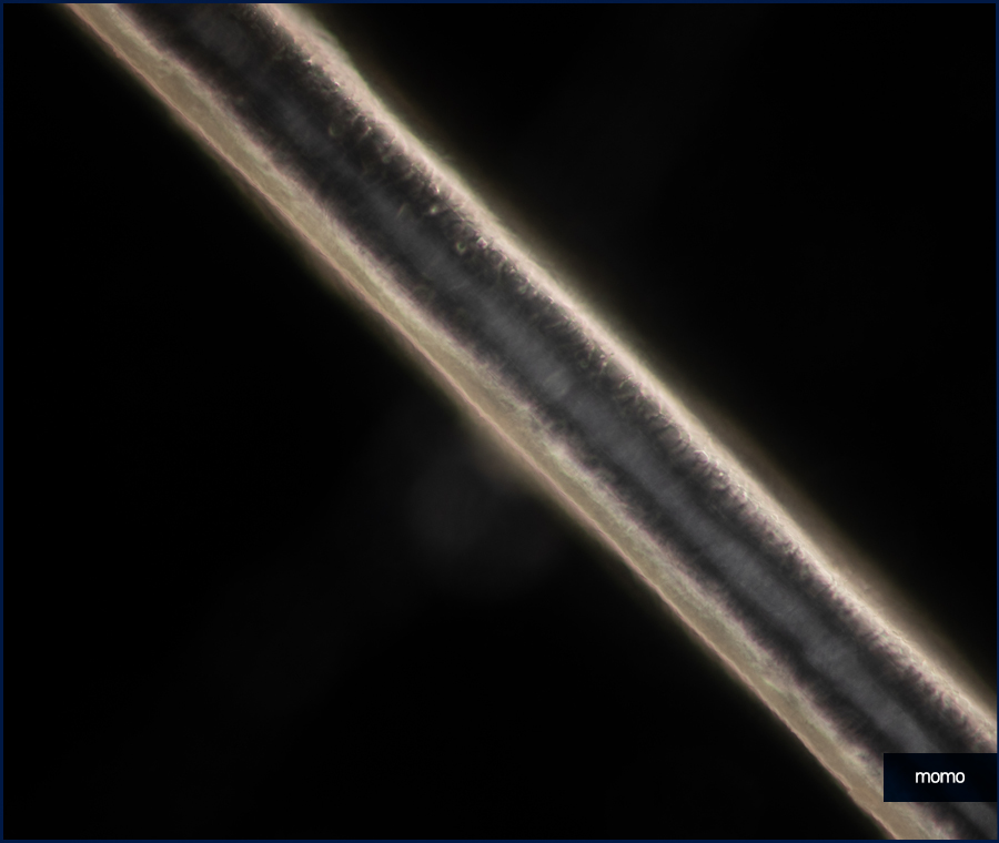 머리카락 끊어짐 이유부터 호전을 위한 Tip 관련 이미지 6