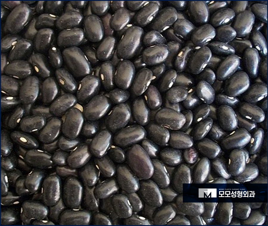 새치나는이유와 처리 방법에 대해 관련 이미지 13