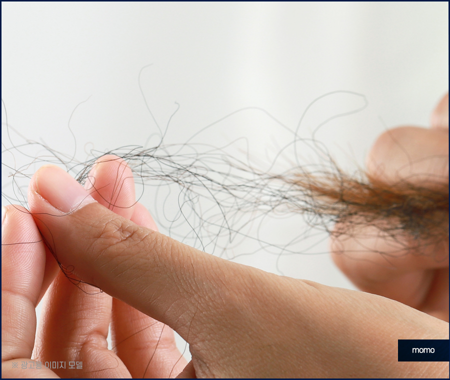 여자m자탈모 헤어라인 디자인까지 고려해 채우는 관련 이미지 3