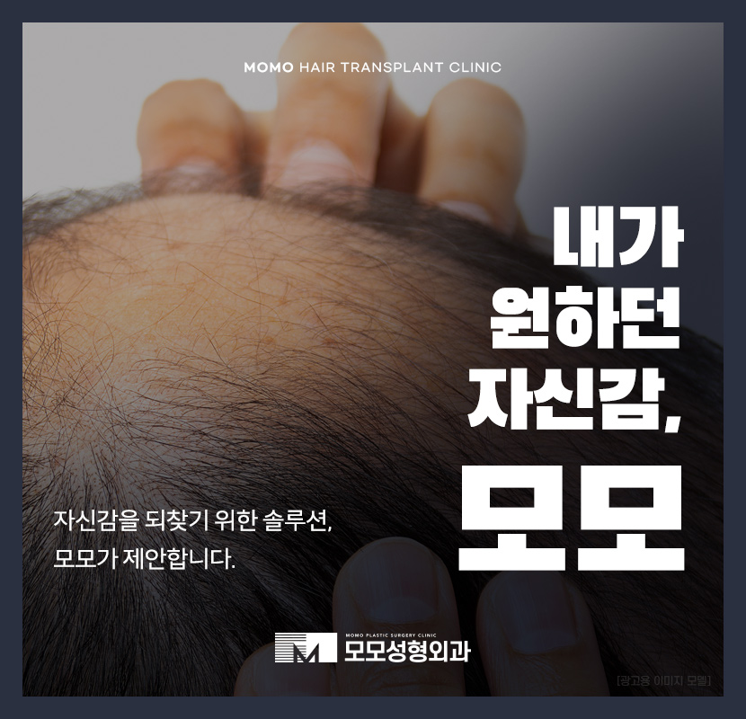 압구정모발이식 원하던 모습을 찾는 포인트 관련 이미지 1