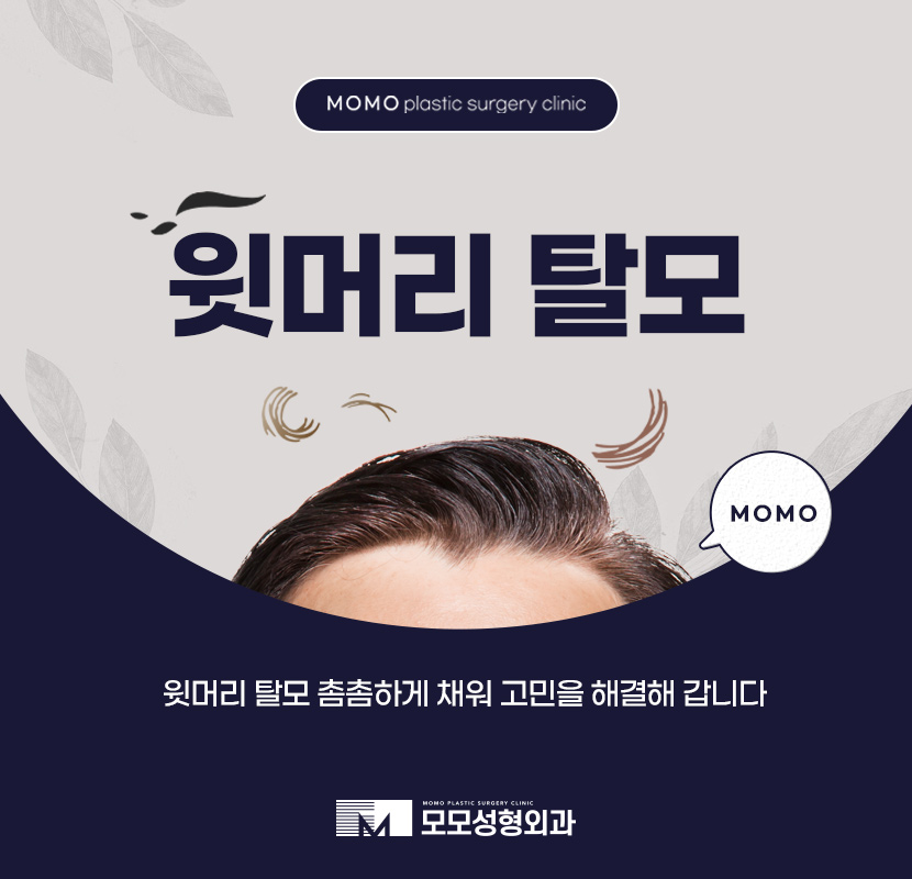 윗머리탈모 촘촘히 채워 고민을 탈출하는 관련 이미지 1