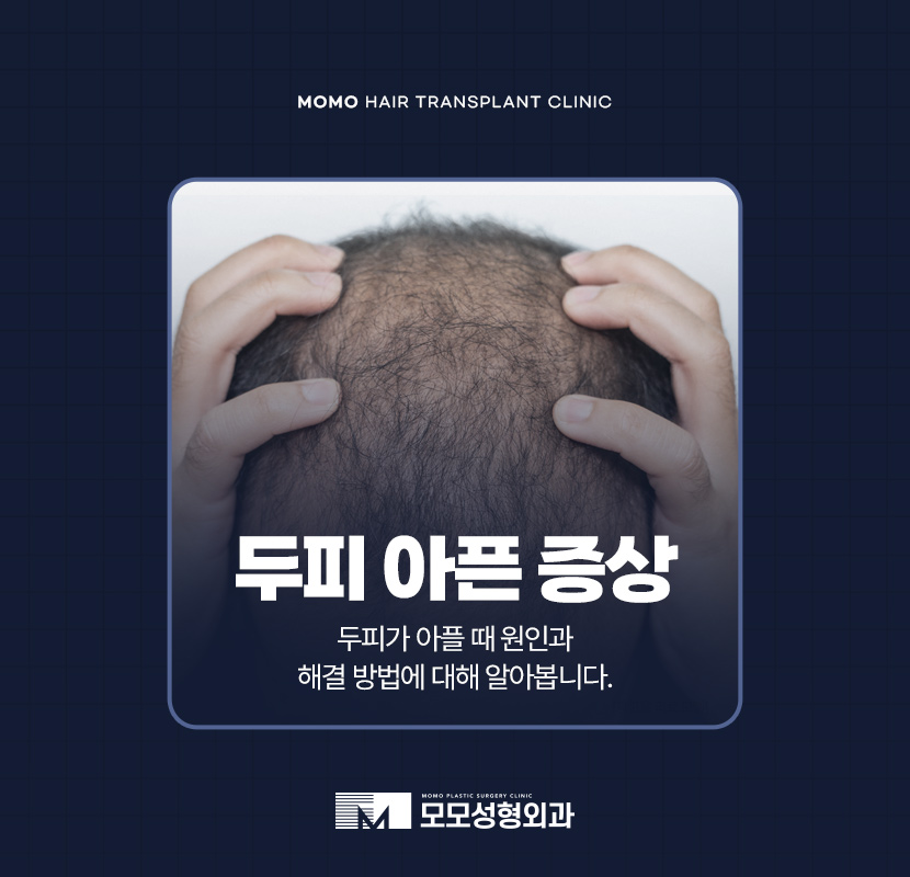 두피가 아파요 증상 원인과 해결하는 방안은 관련 이미지 1