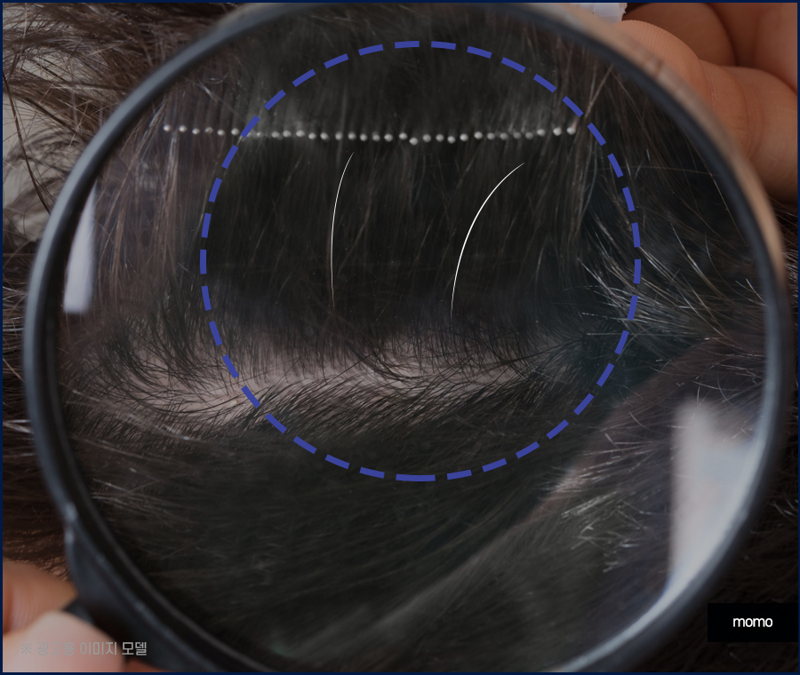 새치나는이유부터 뽑지 말아야 할 이유까지 관련 이미지 3