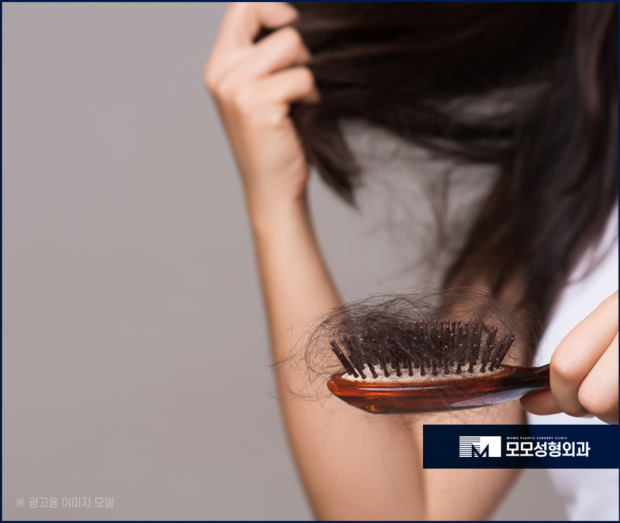 여자M자탈모 외모의 퀄리티를 더하는 보강 방법 관련 이미지 5