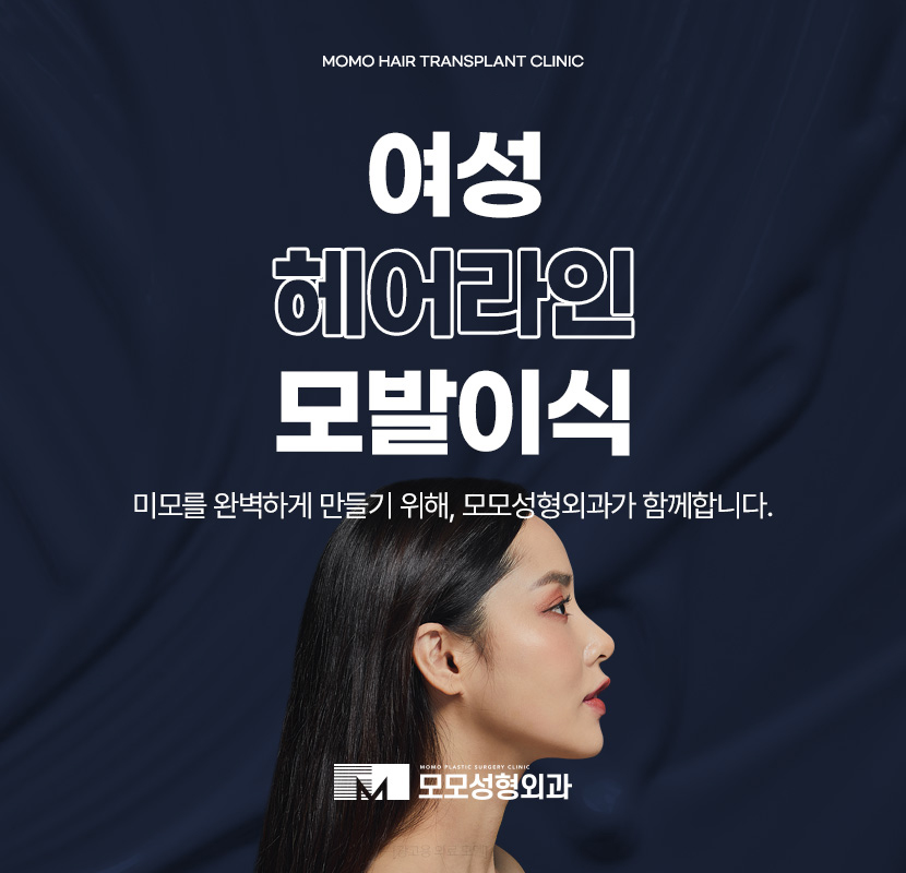 여성 헤어라인 모발이식 미모까지 완벽해 지는 효과 관련 이미지 1