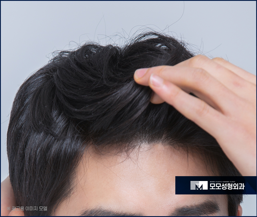 머리감는횟수 어느 정도가 적절할까요 관련 이미지 3