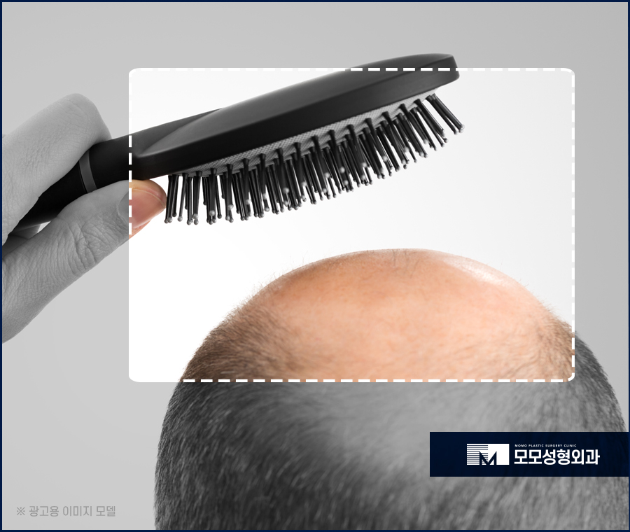 모발 얇아짐 이유와 두께를 복구하는 방법 관련 이미지 5