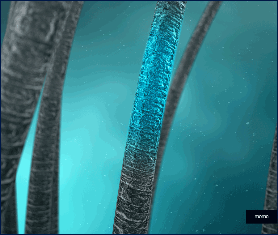 20대 모발이식 성공적인 결과를 위한 필수 조건 관련 이미지 5