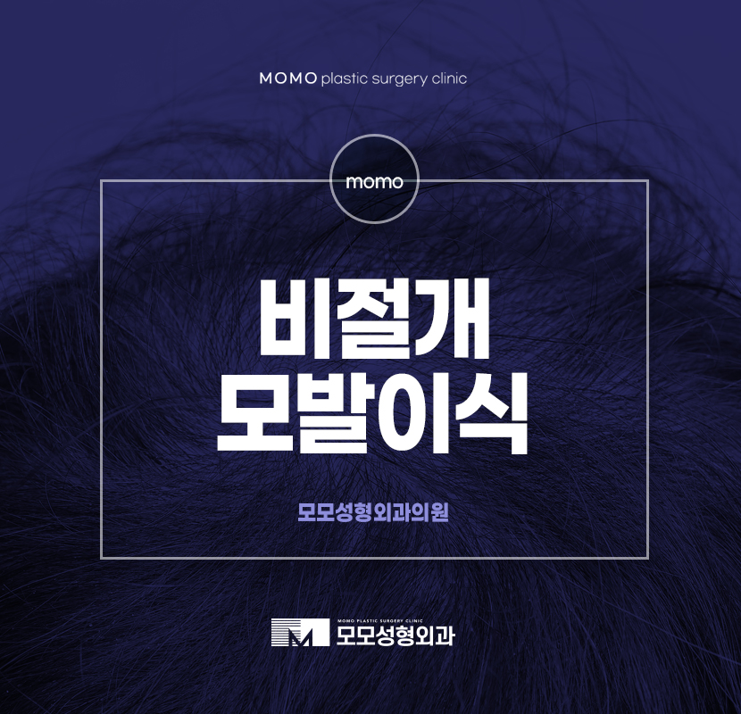 비절개모발이식수술 중요한 부분은 관련 이미지 1