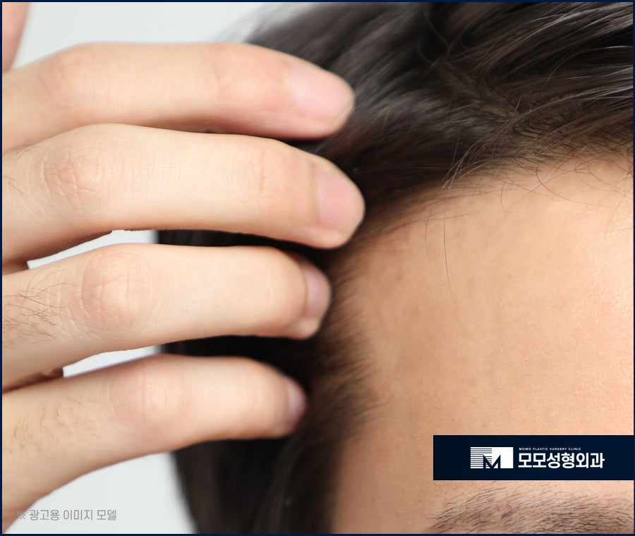 엠자이마 촘촘하게 채워 자연스럽게 보강하는 관련 이미지 3