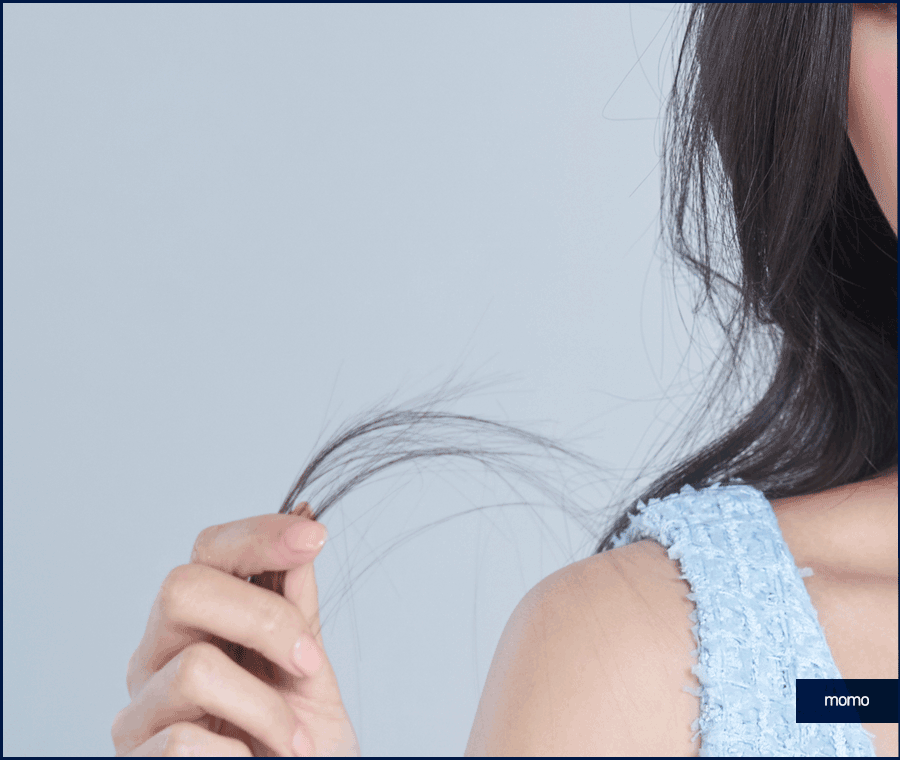 여자 모발이식 헤어라인 교정이 필요하다면 관련 이미지 5