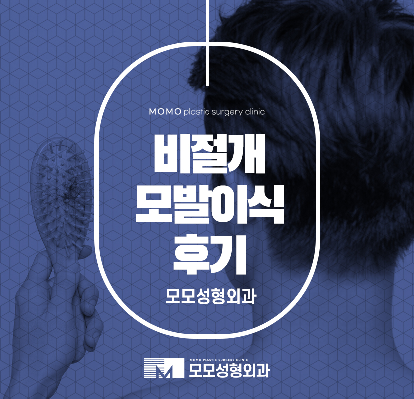 비절개모발이식후기 진단에 맞춰서 관련 이미지 1