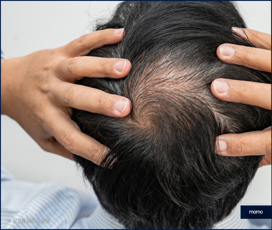 머리 간지러움 원인과 빠른 증상 해소를 위한 tip 관련 이미지 4