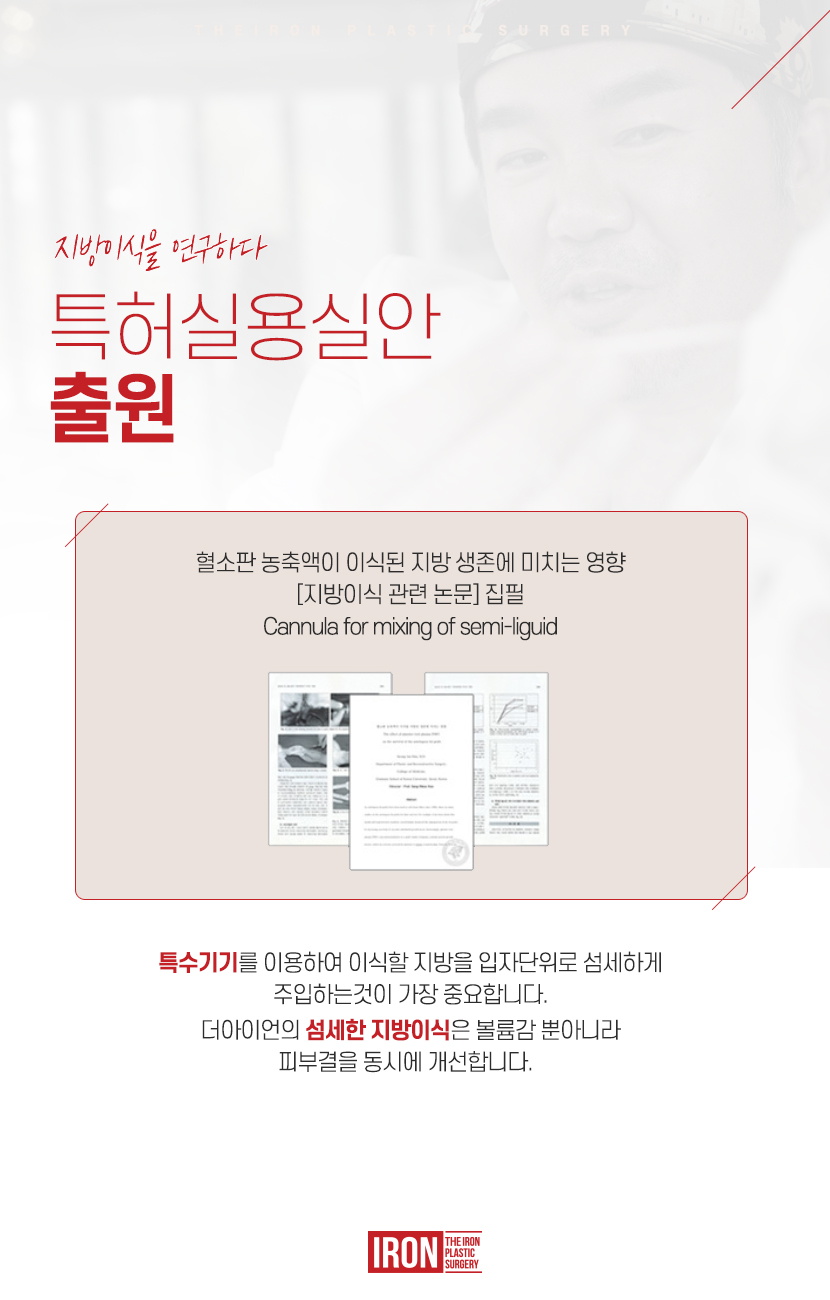 신사 눈밑지방이식 만족스러운 모습을 관련 이미지 6