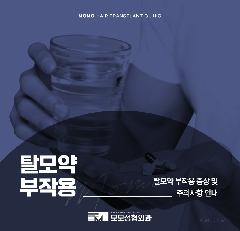 탈모약 부작용 증상 및 주의해야 할 사항 관련 이미지 1
