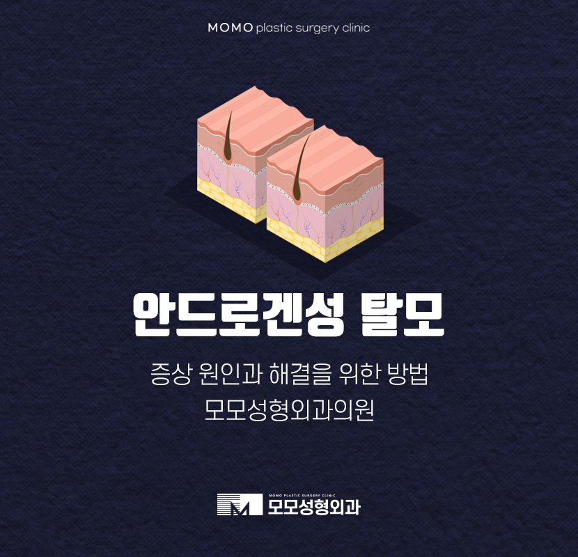 안드로겐성탈모 원인과 개선을 위한 방안은 관련 이미지 1