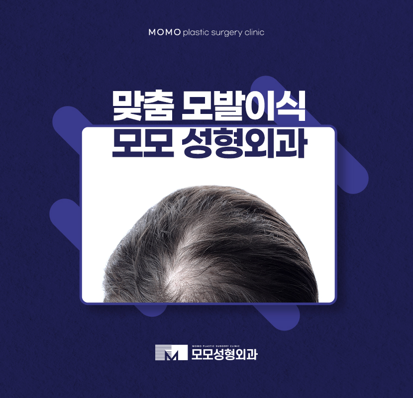 맞춤모발이식 풍성한 결과를 만드는 관련 이미지 1